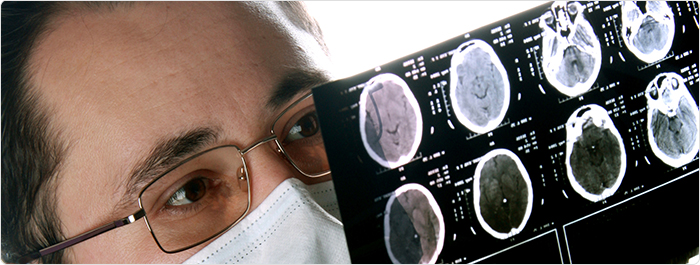 สภาพโตเกินไม่สมส่วน